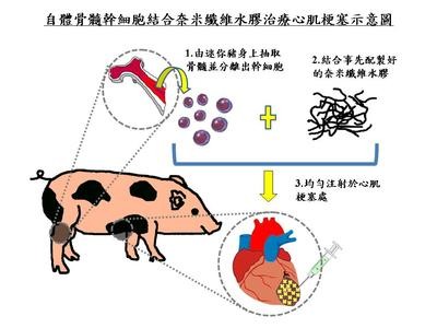 NCKU Research Team Developed New Stem Cell Therapy for Heart Repair, First in the WorldImage